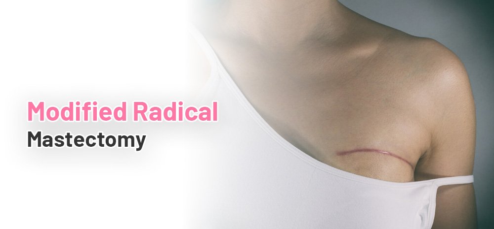 Modified Radical Mastectomy